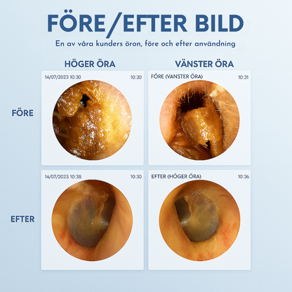 WaxClean™ - Smart öronrengöring med avancerad teknik